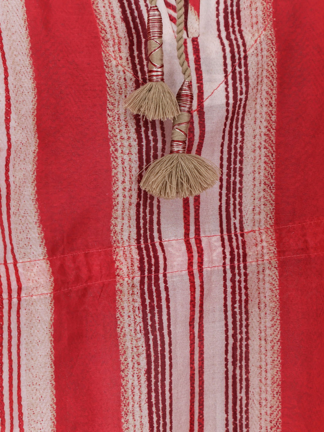 Isabel Marant Dresses - Bright | 92abc087e95ec2b62b87fbb9fc1208005f0949d8